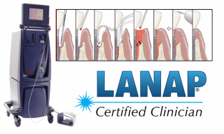 LANAP